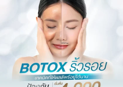 Botox ลดเลือนริ้วรอย